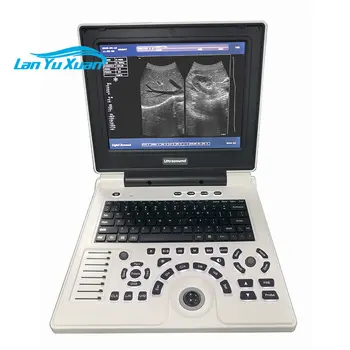 XF30B Augļa Biometriju Phantom Mobilais Skeneris Terapija, Ultraskaņas Iekārtas